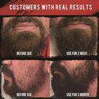 Essentials Beard Kit