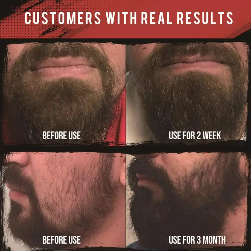 Essentials Beard Kit